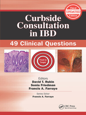 cover image of Curbside Consultation in IBD